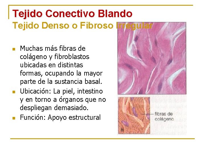 Tejido Conectivo Blando Tejido Denso o Fibroso Irregular n n n Muchas más fibras