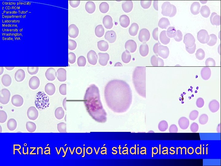 Obrázky převzaty z CD-ROM „Parasite-Tutor“ – Department of Laboratory Medicine, University of Washington, Seatle,