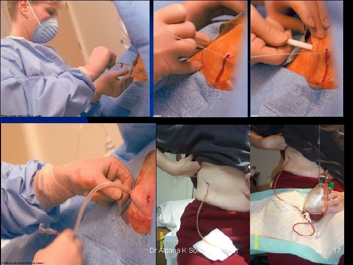 Dr Alpana K Somale, lecturer 17 