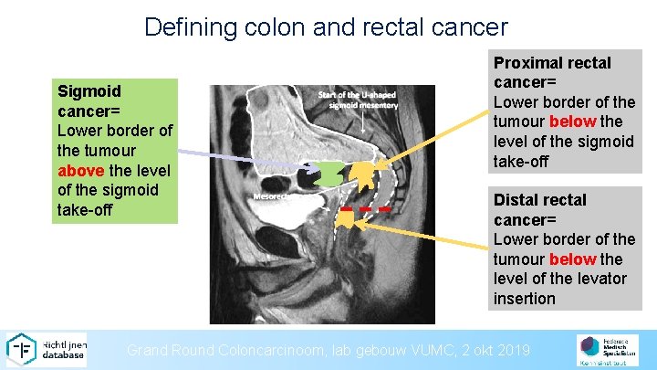 Defining colon and rectal cancer Sigmoid cancer= Lower border of the tumour above the