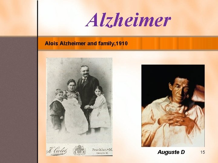 Alzheimer Alois Alzheimer and family, 1910 Auguste D 15 