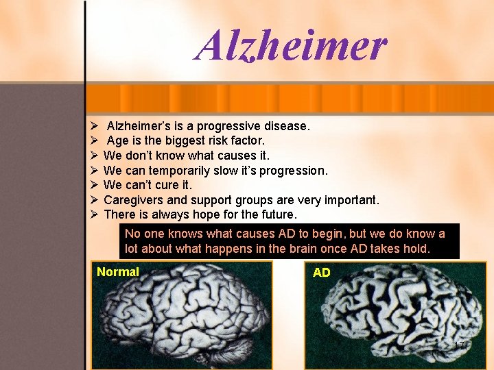 Alzheimer Ø Alzheimer’s is a progressive disease. Ø Age is the biggest risk factor.