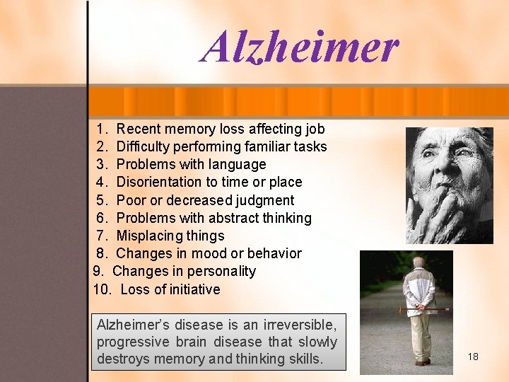 Alzheimer 1. Recent memory loss affecting job 2. Difficulty performing familiar tasks 3. Problems