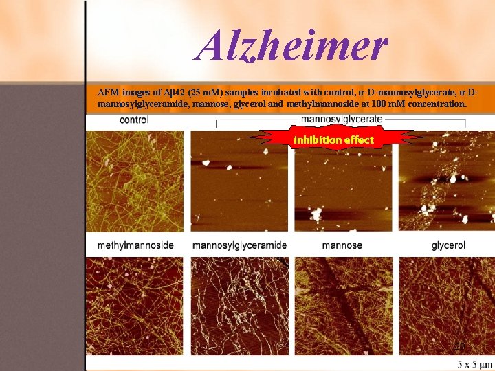 Alzheimer AFM images of Aβ 42 (25 m. M) samples incubated with control, α-D-mannosylglycerate,