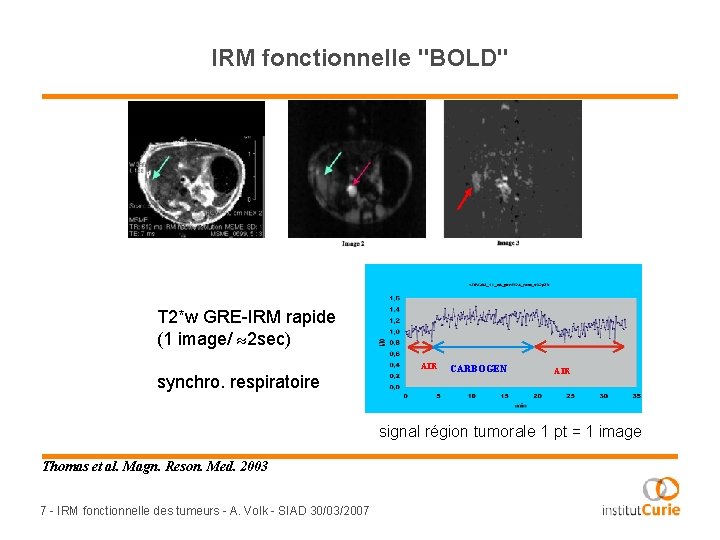 IRM fonctionnelle "BOLD" T 2*w GRE-IRM rapide (1 image/ 2 sec) AIR synchro. respiratoire