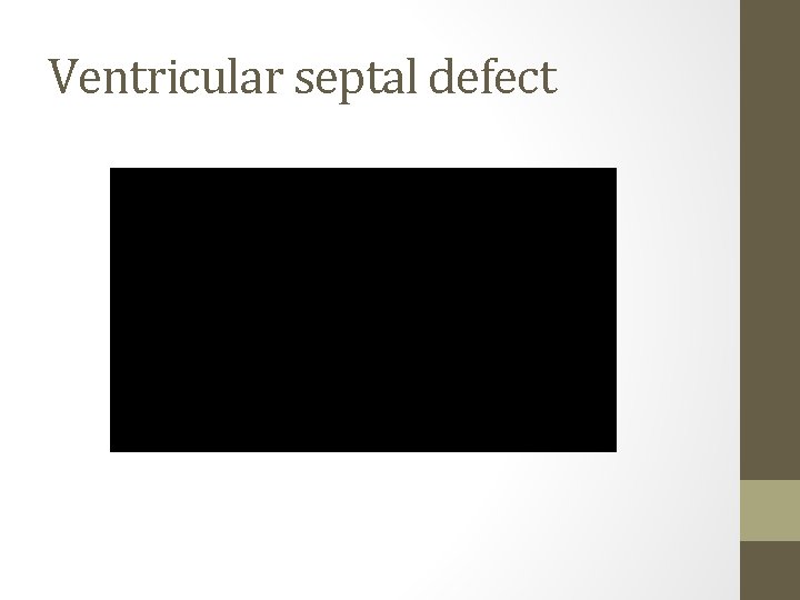 Ventricular septal defect 