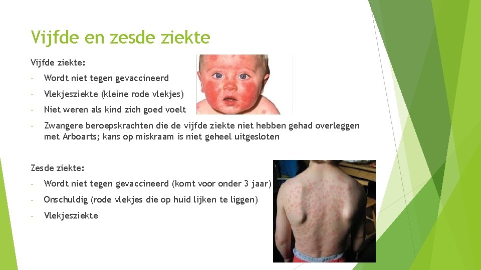 Vijfde en zesde ziekte Vijfde ziekte: - Wordt niet tegen gevaccineerd - Vlekjesziekte (kleine