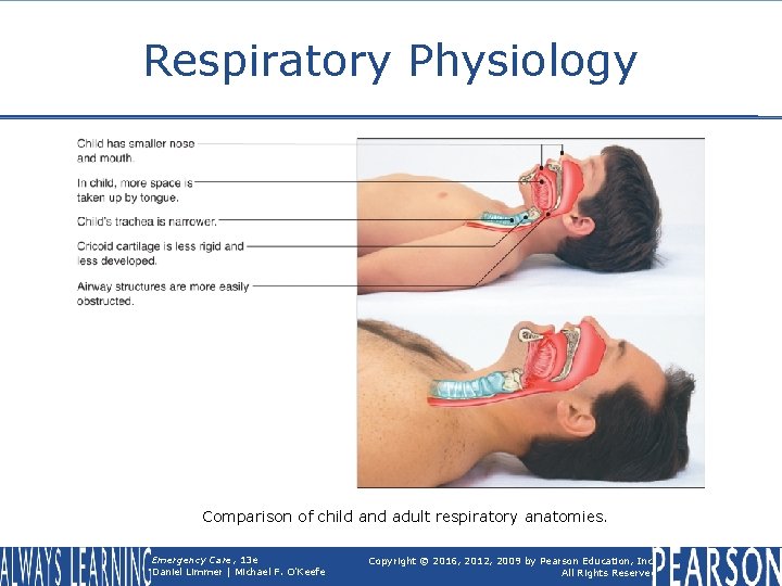 Respiratory Physiology Comparison of child and adult respiratory anatomies. Emergency Care, 13 e Daniel