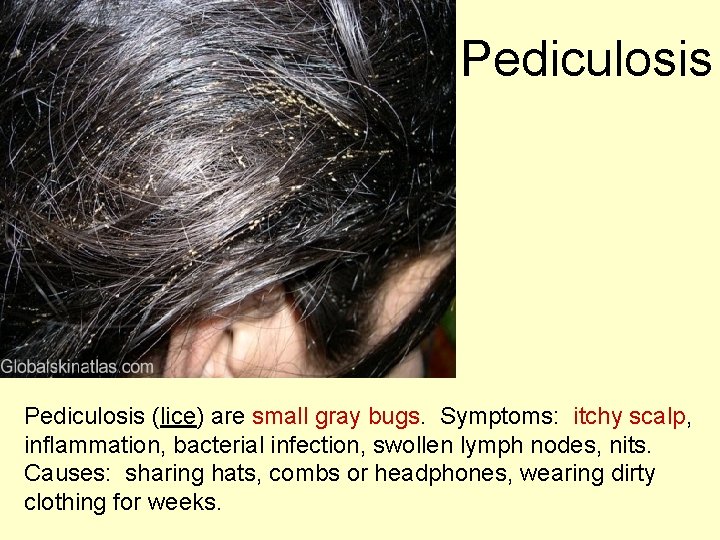 Pediculosis (lice) are small gray bugs. Symptoms: itchy scalp, inflammation, bacterial infection, swollen lymph