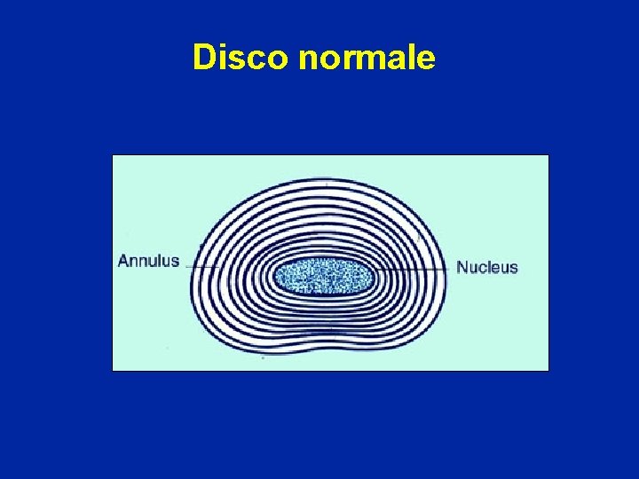Disco normale 