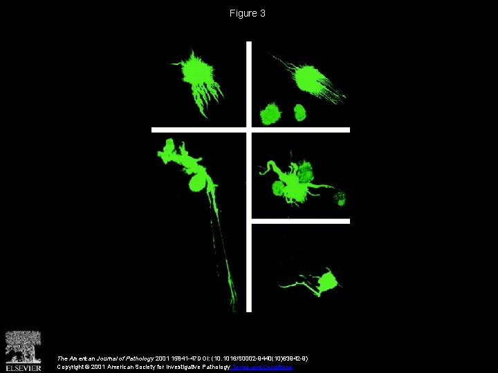 Figure 3 The American Journal of Pathology 2001 15841 -47 DOI: (10. 1016/S 0002