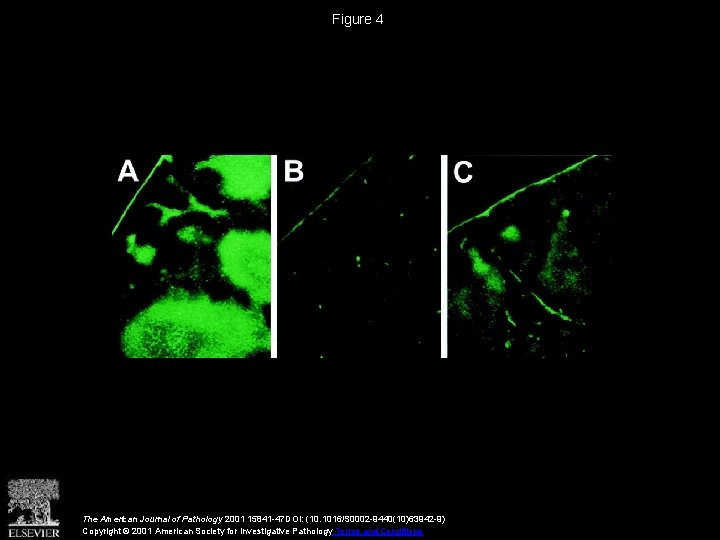 Figure 4 The American Journal of Pathology 2001 15841 -47 DOI: (10. 1016/S 0002