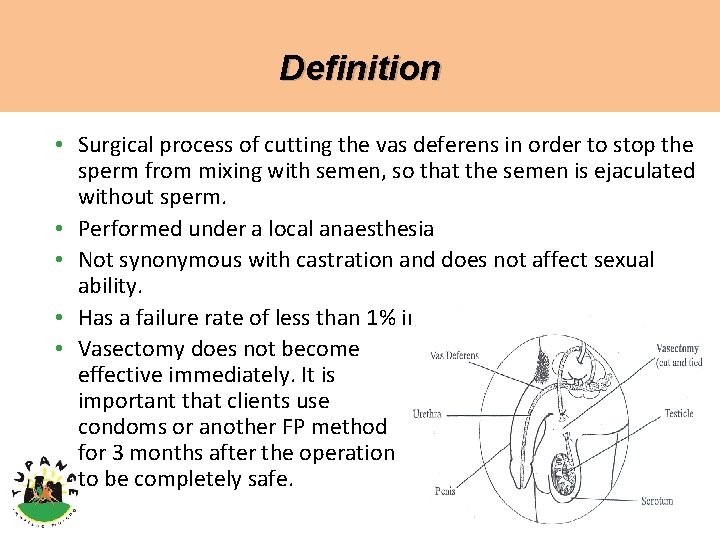 Definition • Surgical process of cutting the vas deferens in order to stop the