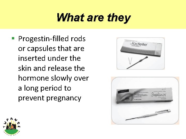 What are they § Progestin-filled rods or capsules that are inserted under the skin