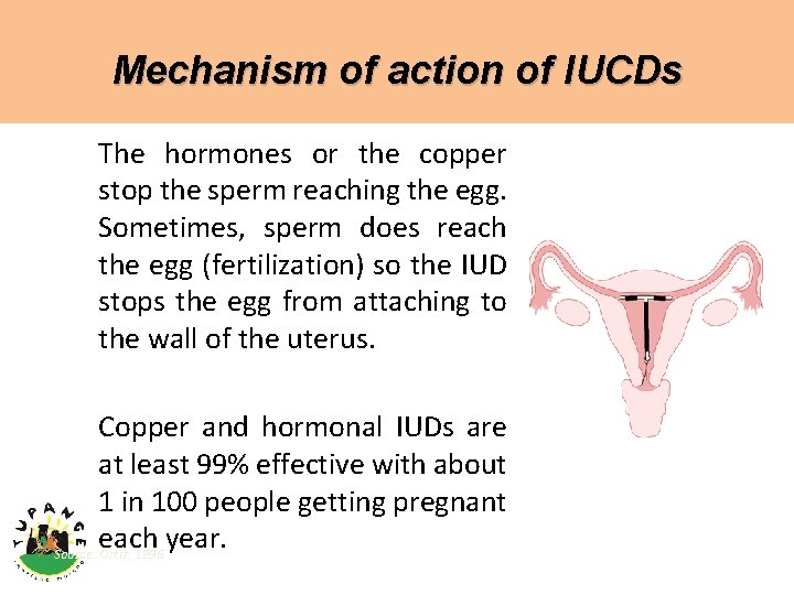 Mechanism of action of IUCDs The hormones or the copper stop the sperm reaching