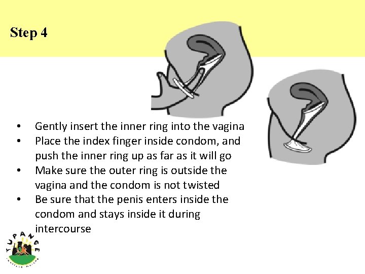 Step 4 • • Gently insert the inner ring into the vagina Place the