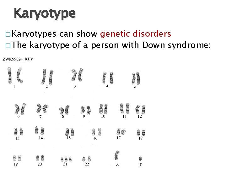 Karyotype � Karyotypes can show genetic disorders � The karyotype of a person with