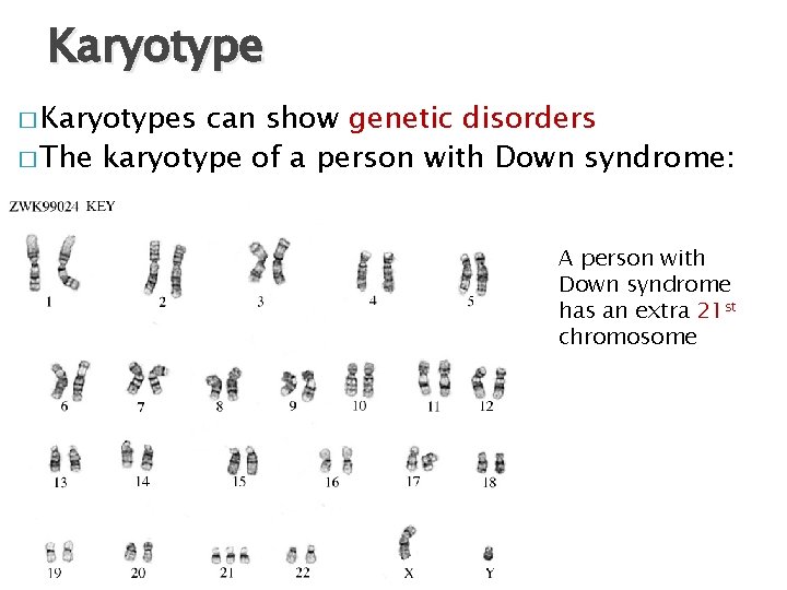 Karyotype � Karyotypes can show genetic disorders � The karyotype of a person with