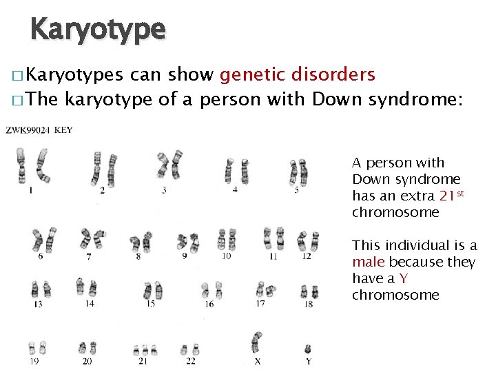 Karyotype � Karyotypes can show genetic disorders � The karyotype of a person with