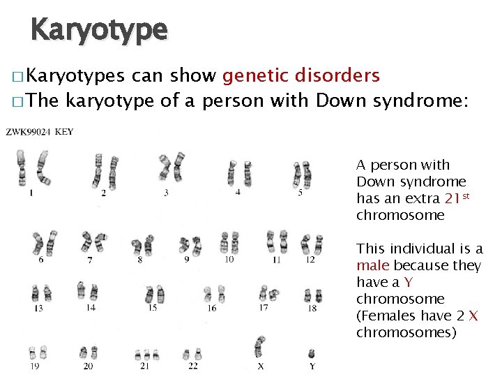 Karyotype � Karyotypes can show genetic disorders � The karyotype of a person with