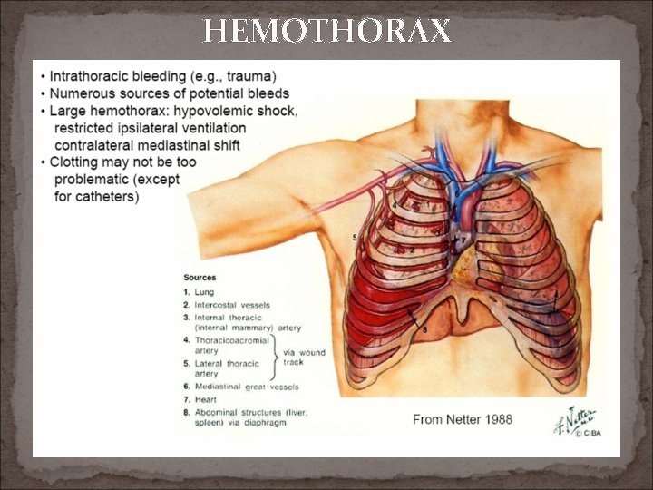 HEMOTHORAX 