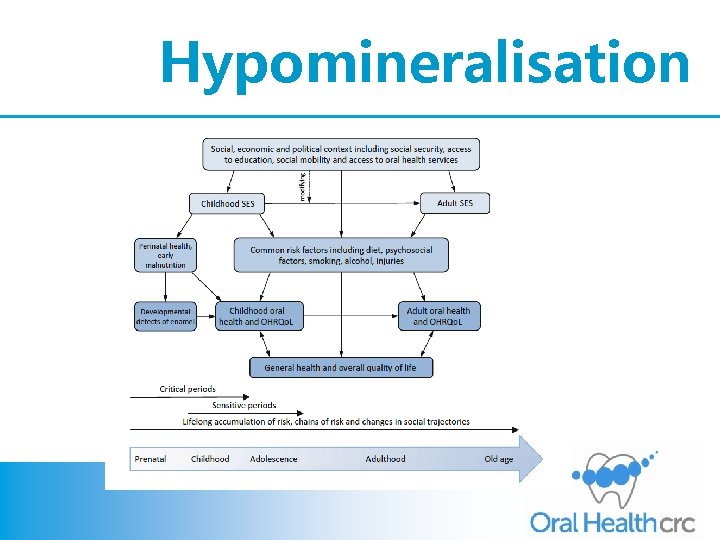 Hypomineralisation 
