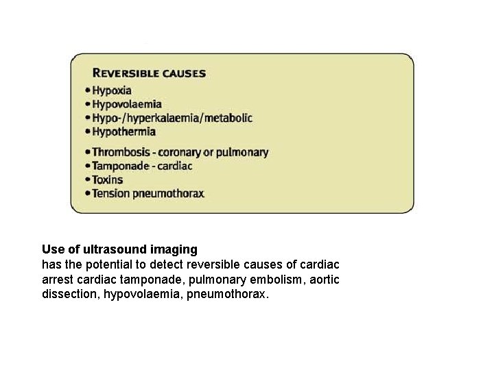 Use of ultrasound imaging has the potential to detect reversible causes of cardiac arrest