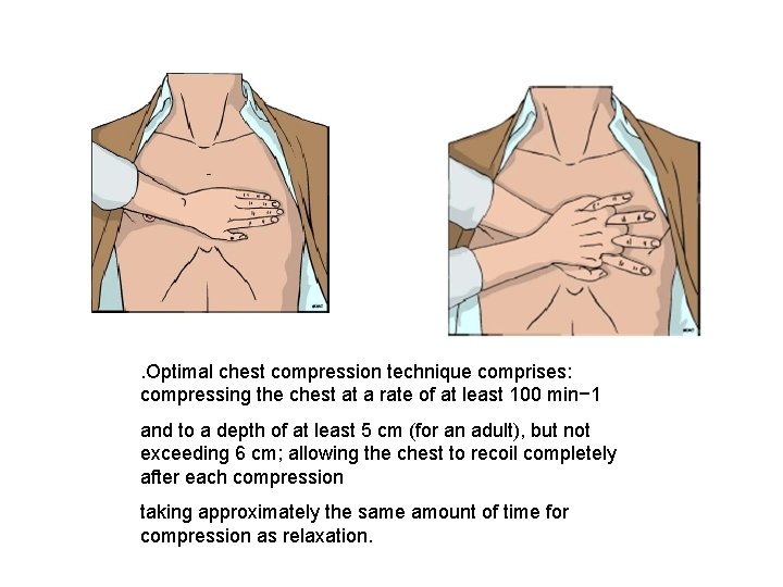 . Optimal chest compression technique comprises: compressing the chest at a rate of at