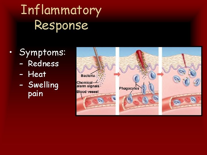 Inflammatory Response • Symptoms: – Redness – Heat – Swelling pain 