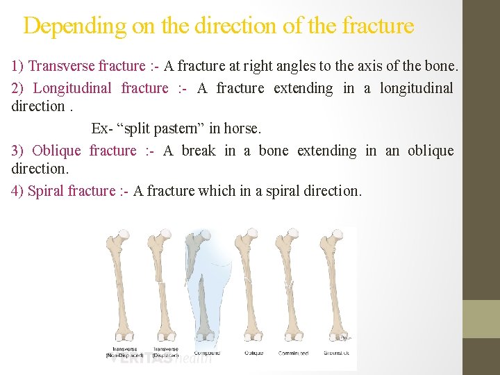 Depending on the direction of the fracture 1) Transverse fracture : - A fracture