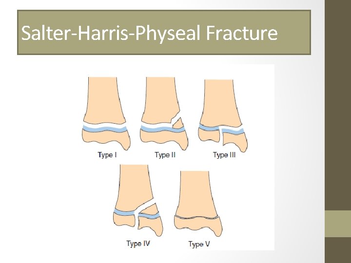 Salter-Harris-Physeal Fracture 