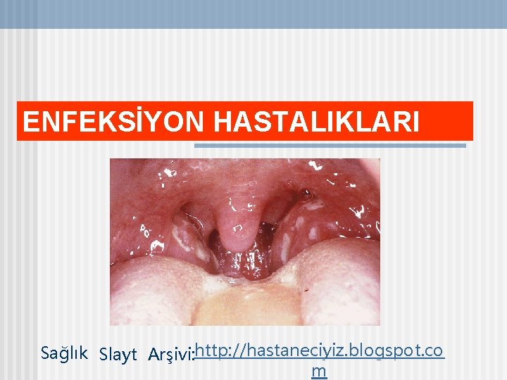 ENFEKSİYON HASTALIKLARI Sağlık Slayt Arşivi: http: //hastaneciyiz. blogspot. co m 