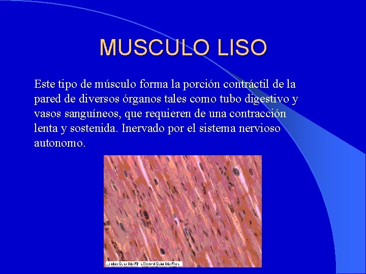 MUSCULO LISO Este tipo de músculo forma la porción contráctil de la pared de