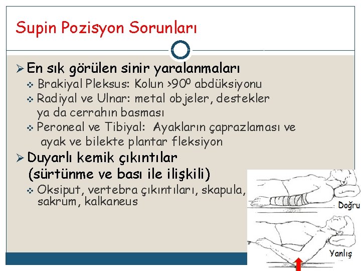 Supin Pozisyon Sorunları Ø En sık görülen sinir yaralanmaları v Brakiyal Pleksus: Kolun >900