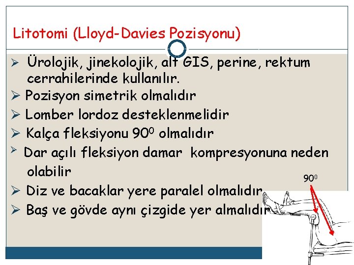 Litotomi (Lloyd-Davies Pozisyonu) Ø Ürolojik, jinekolojik, alt GIS, perine, rektum cerrahilerinde kullanılır. Ø Pozisyon