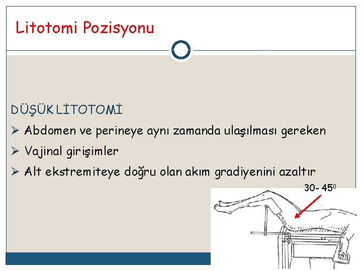 Litotomi Pozisyonu DÜŞÜK LİTOTOMİ Ø Abdomen ve perineye aynı zamanda ulaşılması gereken Ø Vajinal