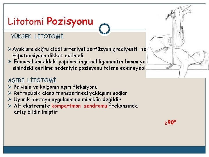 Litotomi Pozisyonu YÜKSEK LİTOTOMİ ØAyaklara doğru ciddi arteriyel perfüzyon gradiyenti nedeniyle sistemik Hipotansiyona dikkat