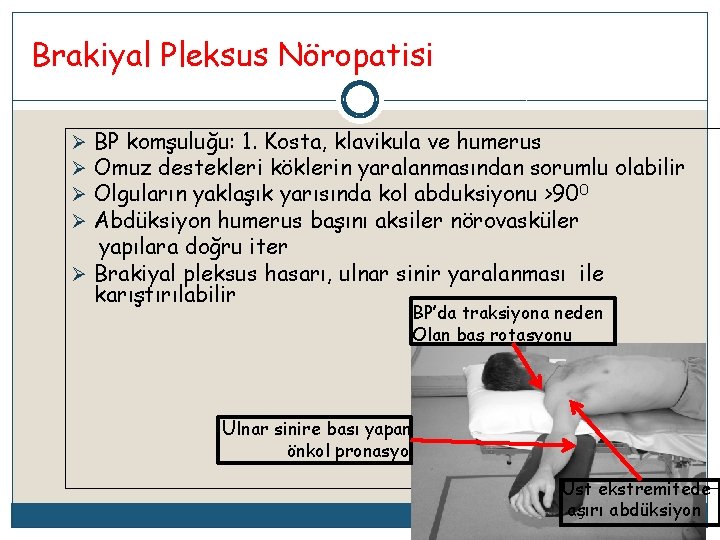 Brakiyal Pleksus Nöropatisi BP komşuluğu: 1. Kosta, klavikula ve humerus Omuz destekleri köklerin yaralanmasından