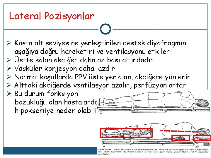 Lateral Pozisyonlar Ø Kosta alt seviyesine yerleştirilen destek diyafragmın aşağıya doğru hareketini ve ventilasyonu