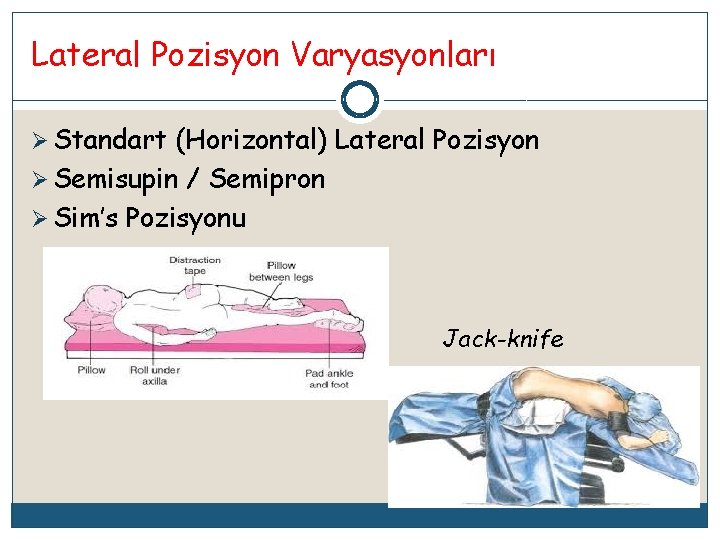 Lateral Pozisyon Varyasyonları Ø Standart (Horizontal) Lateral Pozisyon Ø Semisupin / Semipron Ø Sim’s