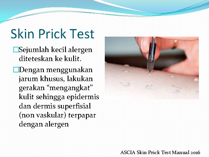 Skin Prick Test �Sejumlah kecil alergen diteteskan ke kulit. �Dengan menggunakan jarum khusus, lakukan