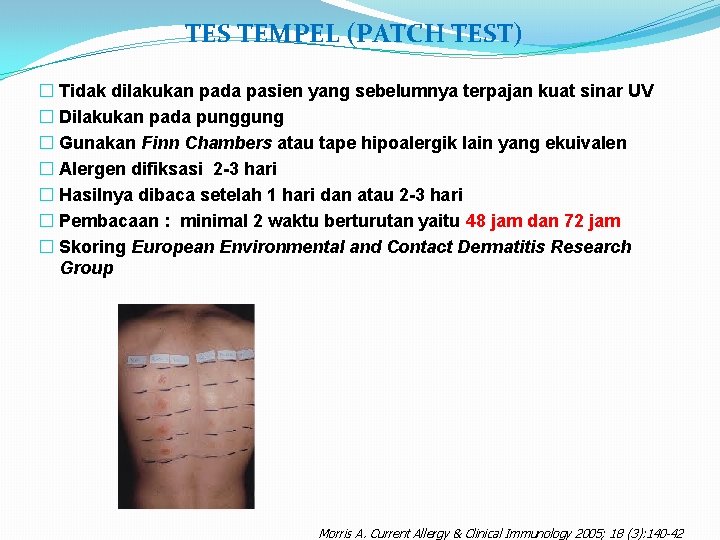 TES TEMPEL (PATCH TEST) � Tidak dilakukan pada pasien yang sebelumnya terpajan kuat sinar