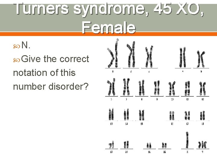 Unit 9 around the room Review Albinism Autosomal