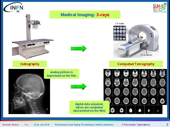 Medical Imaging: X-rays radiography Computed Tomography analog picture is impressed on the film digital