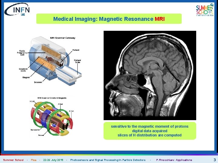 Medical Imaging: Magnetic Resonance MRI sensitive to the magnetic moment of protons digital data