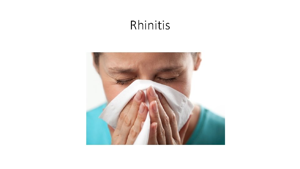Rhinitis 