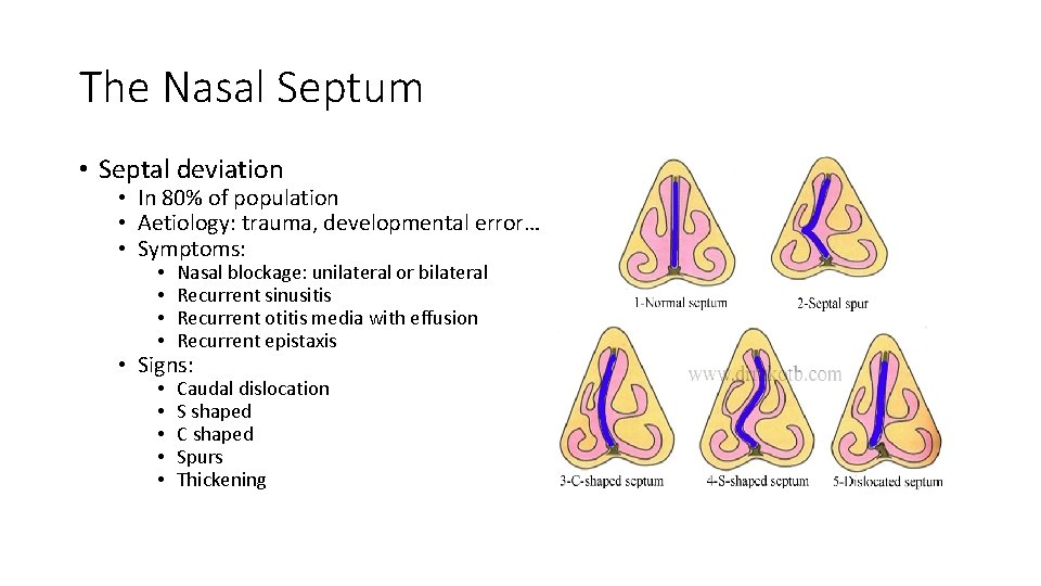 The Nasal Septum • Septal deviation • In 80% of population • Aetiology: trauma,