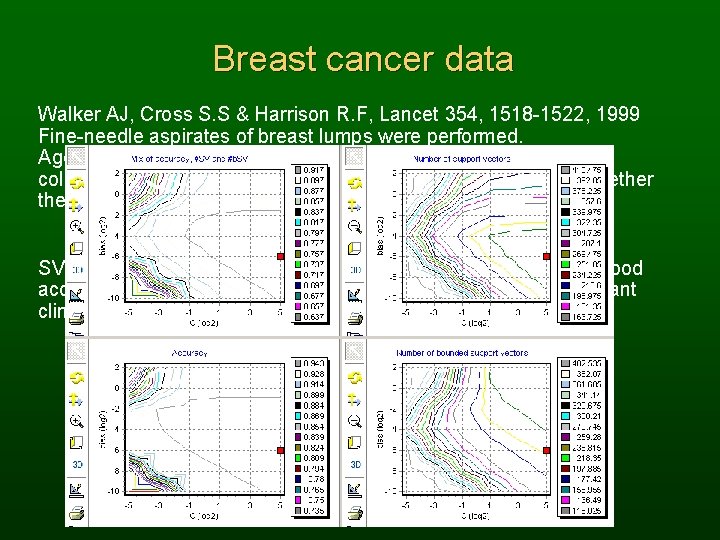 Breast cancer data Walker AJ, Cross S. S & Harrison R. F, Lancet 354,