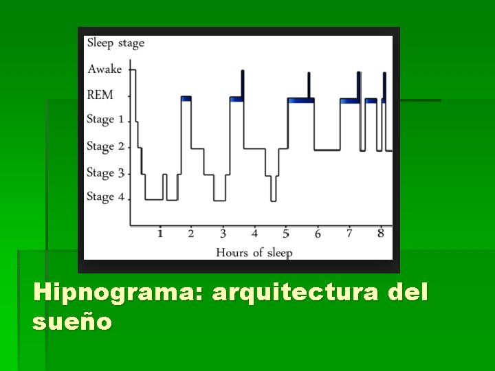 Hipnograma: arquitectura del sueño 