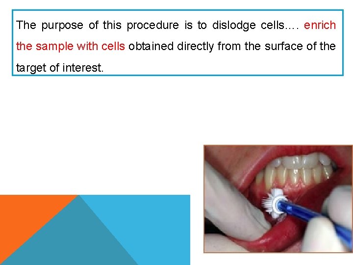 The purpose of this procedure is to dislodge cells…. enrich the sample with cells The purpose of this procedure is to dislodge cells…. enrich the sample with cells